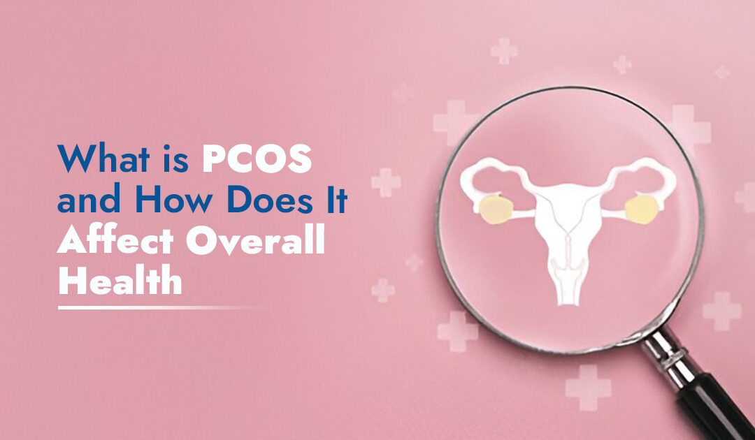 What is PCOS and How Does It Affect Overall Health