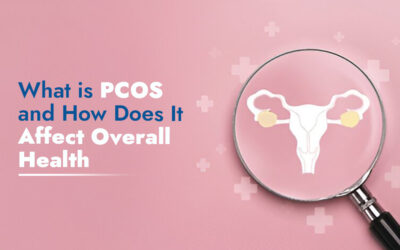 What is PCOS and How Does It Affect Overall Health