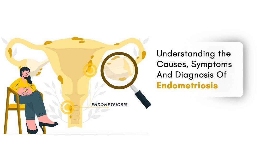 Understanding the Causes, Symptoms And Diagnosis Of Endometriosis